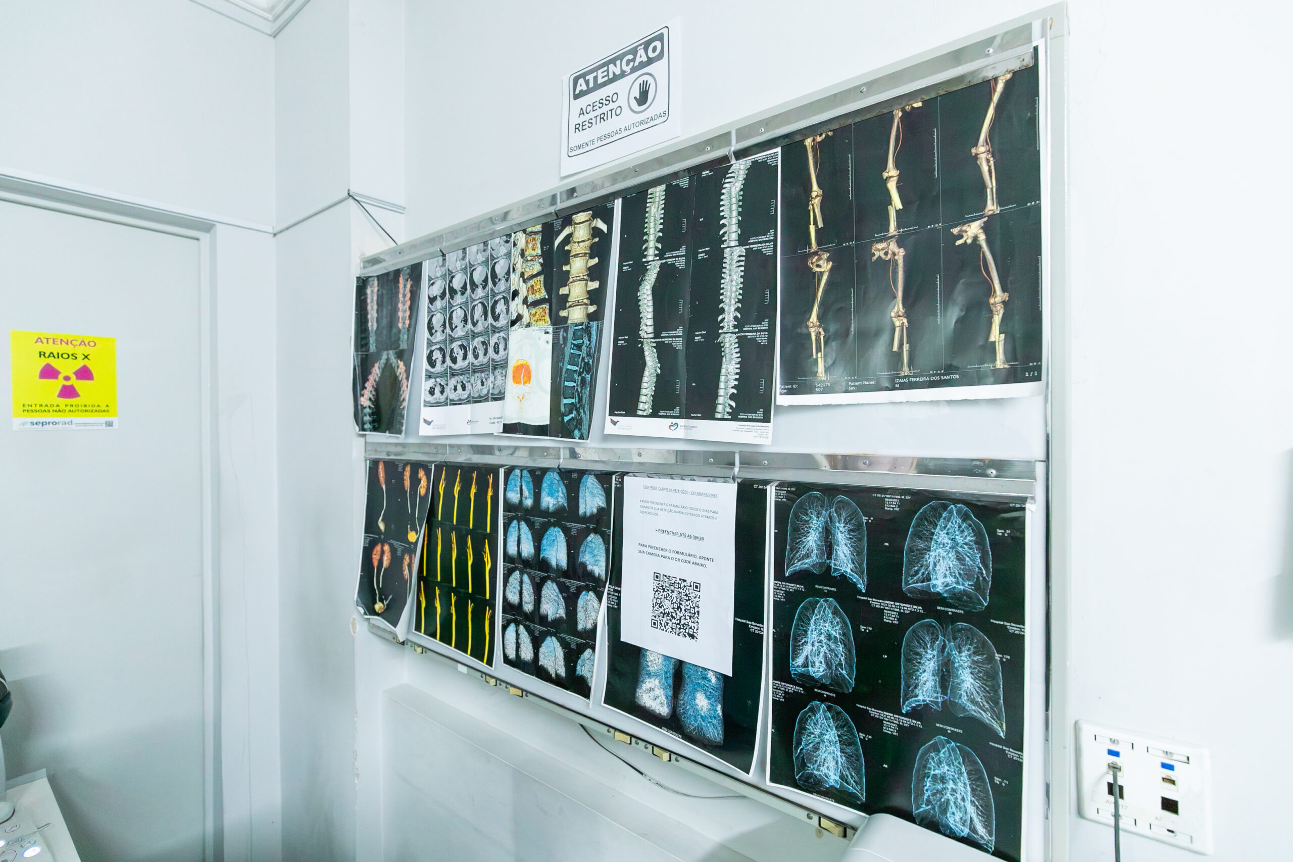 Cuiabá instala ressonância magnética de última geração no São Benedito